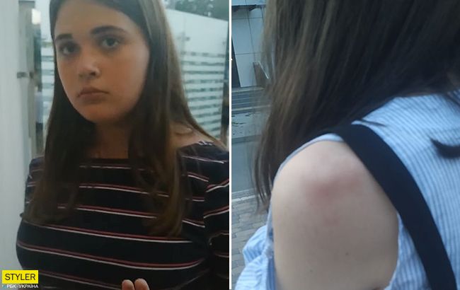 У Чернівцях натовп підлітків знущався над дівчинкою: перехожі не втручалися (відео)