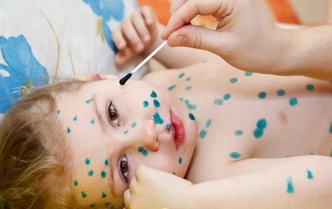 Родители бьют тревогу: на Закарпатье у детей появилась странная аллергия