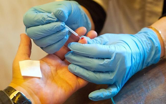 Вчені вперше за 19 років виявили новий штам ВІЛ