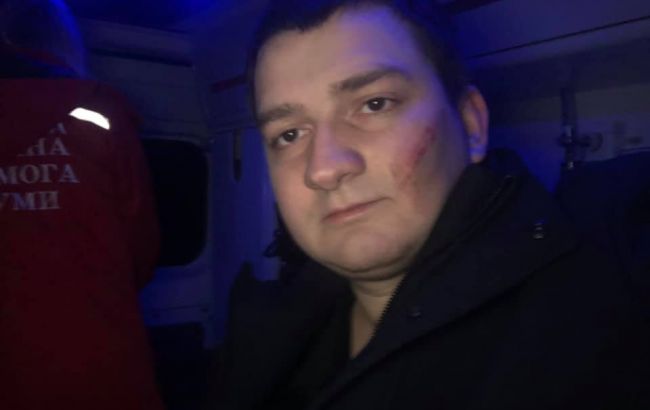 Депутат от "Слуги народа" заявил о нападении на него