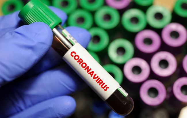 Лаборатория Житомира приостановила прием материалов для тестирования на COVID-19