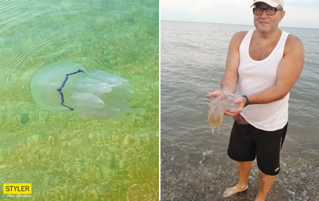 Пляжі Азовського моря атакують небезпечні медузи: люди показують опіки