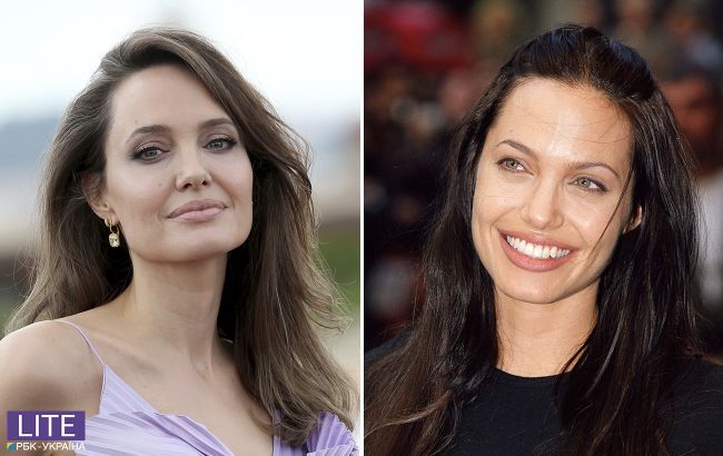 Анджеліна Джолі і пластика: що змінювала в собі актриса заради ідеальної зовнішності
