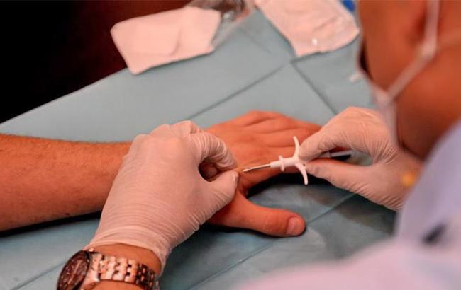 В Україні вперше імплантували людині чіп у руку