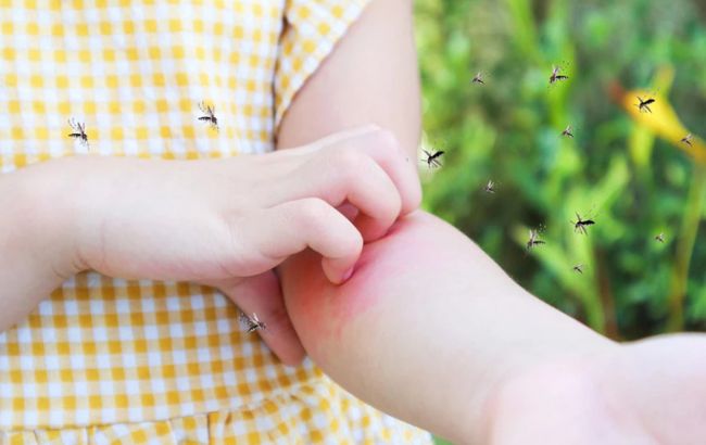 Что делать, если ребенка покусали комары или мошки: первая помощь