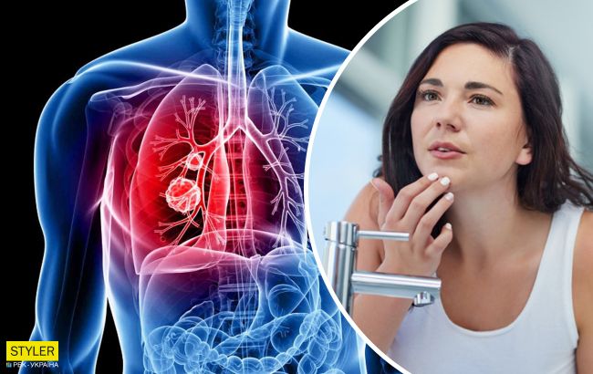 Симптоми раку легенів: лікарі назвали неочевидні ознаки в руках і на обличчі