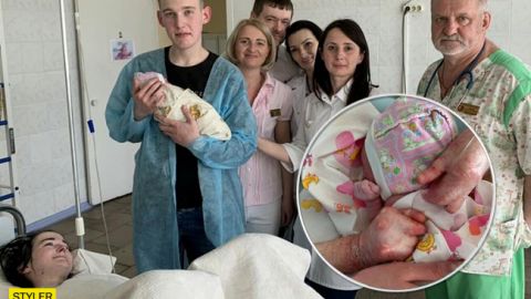 Справжнє диво: у Дніпрі жінка-метелик народила дитину (фото)