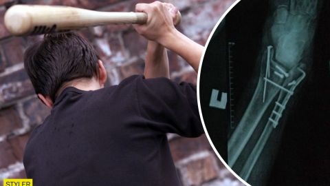 У Запоріжжі молодики по-звірячому побили пенсіонерів на дорозі