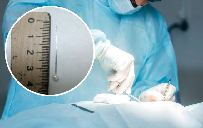 Застрягла прямо у трахеї: в Одеській області підліток випадково вдихнув шпильку