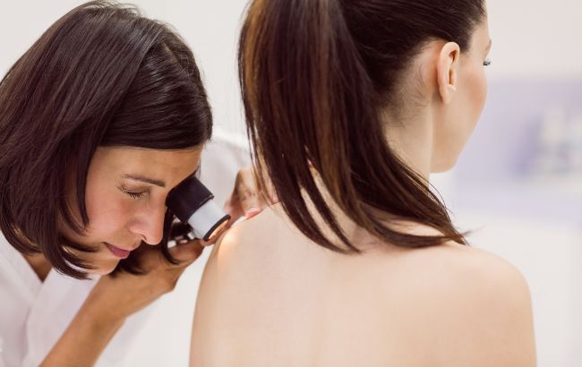 Дерматологи назвали пять скрытых признаков рака кожи: проверьте себя немедленно