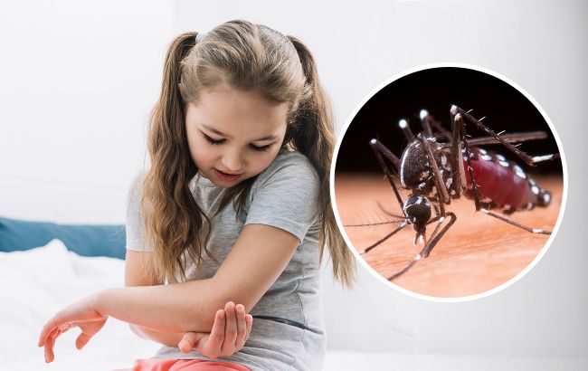 Как ухаживать за раной после укуса комара, чтобы она быстрее зажила: советы педиатра