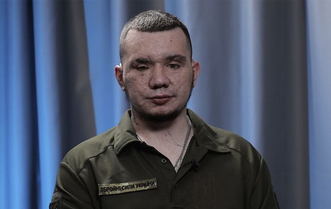 Сапер Владислав Єщенко, який втратив зір на війні: Я побачу перемогу на власні очі