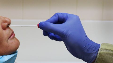 Майже 400 доларів різниці: скільки коштує ПЛР-тест на COVID в аеропортах світу