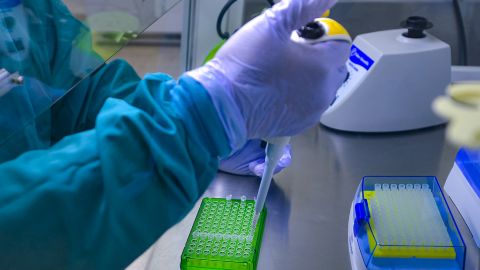 В Японии ученым удалось вакциной убить ВИЧ в организме обезьяны