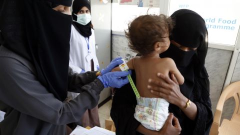 В ООН закликають країни G20 запобігти голоду в Афганістані: діти недоїдають