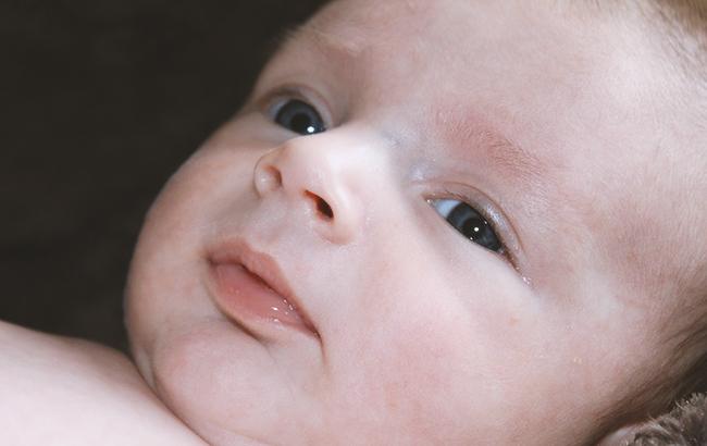 "Згорів" від менінгіту: під Херсоном через недбалість батьків померла дитина