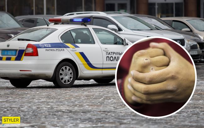 У Києві охоронець парковки розбив голову водію, який залишив авто "не там" (фото)