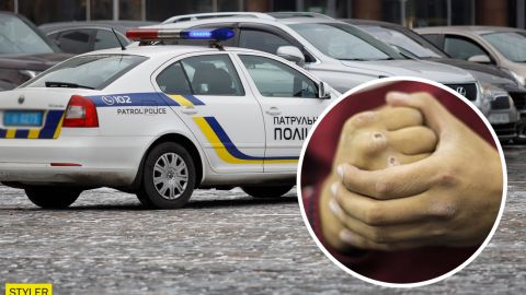 В Киеве толпа избила парня за накрашенные губы: появилось видео