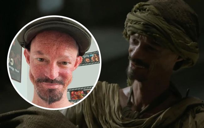 Помер актор культового серіалу "Гра престолів". Даррену Кенту було лише 36 років