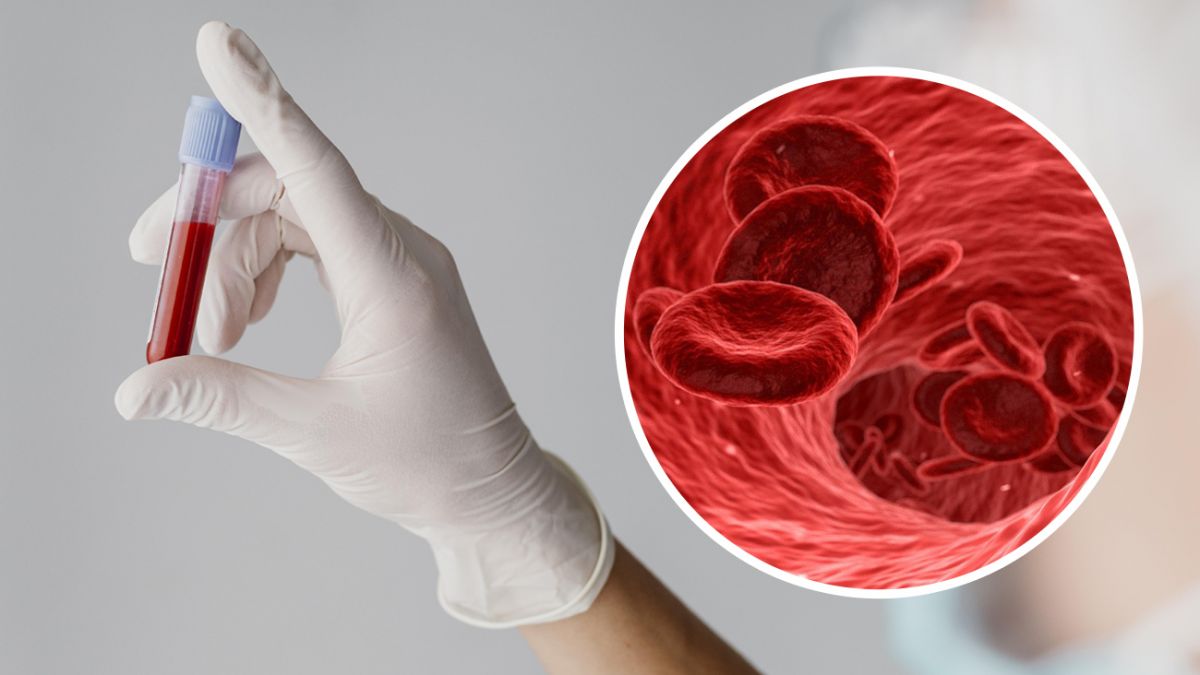 Что такое анемия и как с ней бороться?
