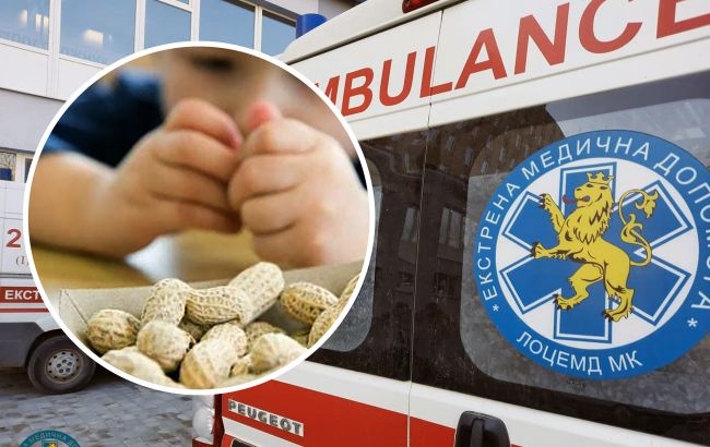 Легкие были забиты арахисом: во Львове врачи чудом спасли малыша