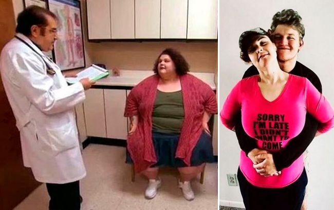 Жінка скинула 179 кілограмів без дієт і спорту: як їй це вдалося (фото)
