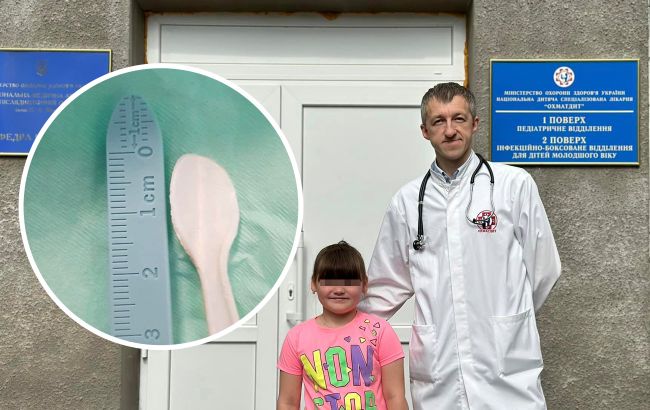 В Україні в організмі дитини виявили ложку, яка знаходилась там кілька місяців (фото)