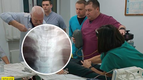 В Черкассах врачи вытащили из горла ребенка иглу: что запрещено делать в такой ситуации (фото)