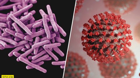 У МОЗ розповіли, як відрізнити COVID-19 від туберкульозу: названо ключові симптоми