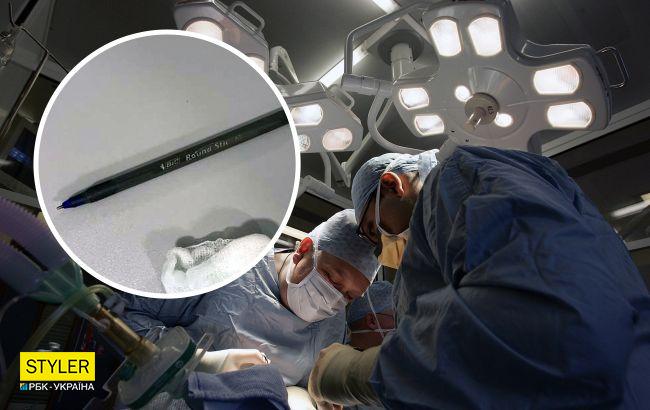 Українець через спір проковтнув кулькову ручку і потрапив на операційний стіл (фото)