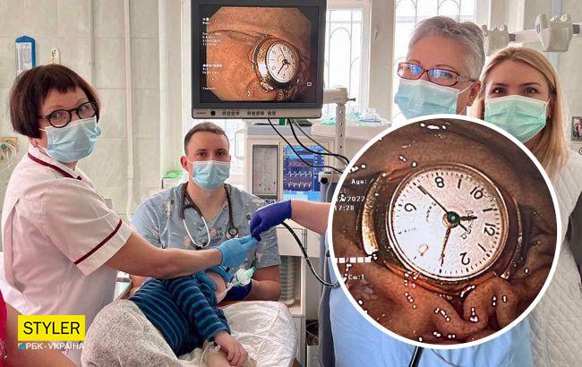 У Києві лікарі врятували 3-річного хлопчика, який проковтнув годинник (фото)