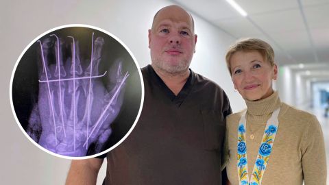 Сенсаційні знахідки археологів змінюють уявлення, де насправді зародився Львів