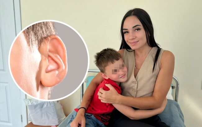 Во Львове мальчик получил новую барабанную перепонку уникальным методом: детали операции