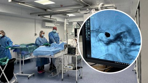 Ні одного розрізу: українські медики врятували життя жінці з величезною аневризмою