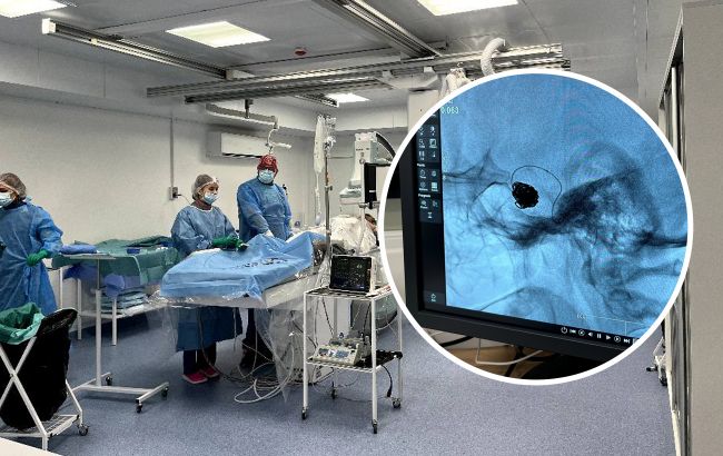 Ни одного разреза: украинские медики спасли жизнь женщине с огромной аневризмой