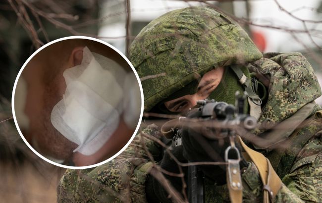 Снайпер попал в голову: в Днепре врачам чудом удалось спасти жизнь военному