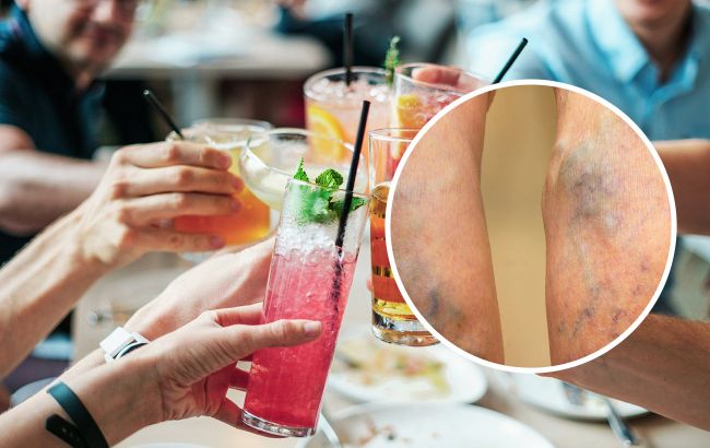 Артерии затвердеют и посинеют: какие напитки вызывают образование тромбов у человека