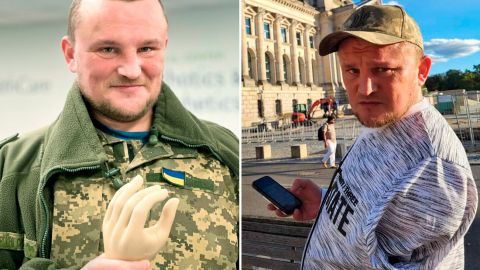 "Приходится просить, чтобы уступили место". Воин ВСУ - о жизни с протезом, реакции общества и что держит на плаву