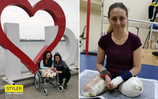 Медсестра з Лисичанська лишилася без ніг і частини руки: тепер вона зірка соцмереж і надихає інших