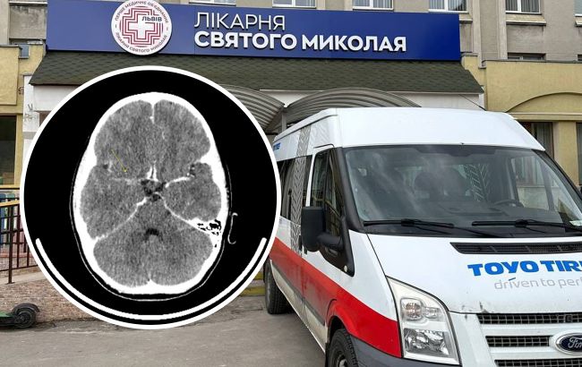 Вдалось вчасно встановити діагноз: у Львові врятували дитину з дуже рідкісною хворобою
