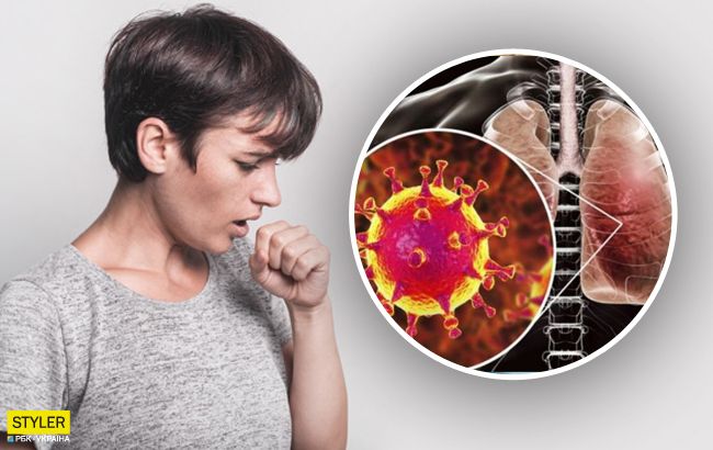 Як коронавірус знищує легені: лікарі показали нове відео