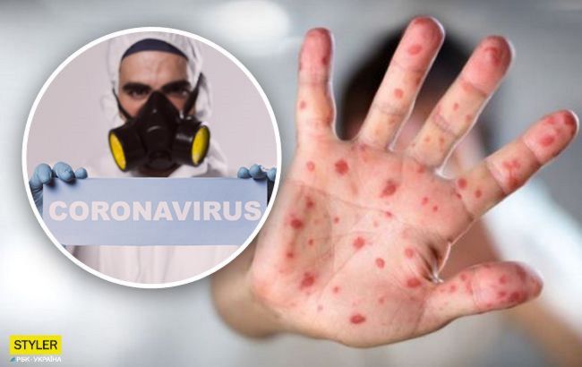 О заражении COVID-19 может рассказать кожа: какие симптомы