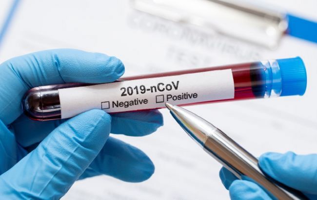 Во Франции начинают первые кампании массового тестирования на коронавирус