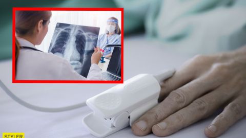 Вчені пояснили важку форму COVID-19: не хронічні хвороби