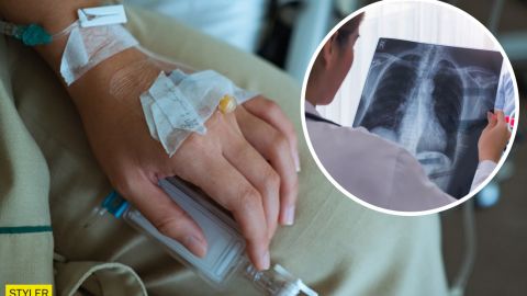 Лікарка про Омікрон: "люди не вірили у свою смерть, а легені згоріли цілковито і повністю"