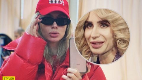 Приховує наслідки: Лобода підігріла чутки про невдалу пластику (фото)