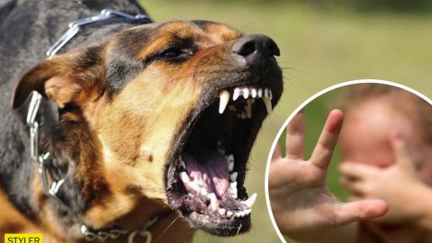 У Черкасах в реанімацію з жахливими травмами потрапив онук власників "розплідника" собак