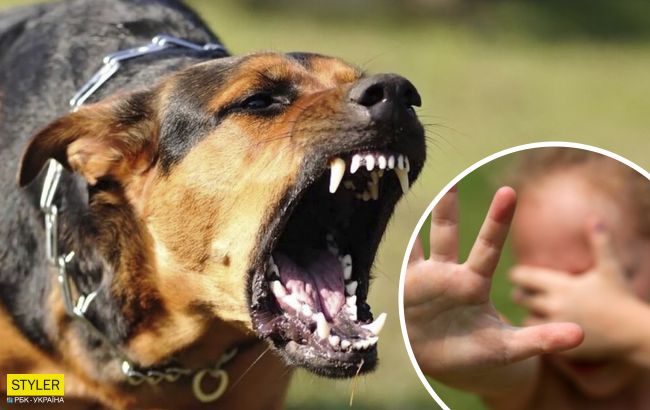 В Черкассах в реанимацию с жуткими травмами попал внук владельцев "питомника" собак