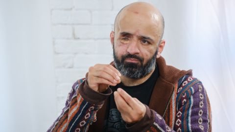 "Проблема в том, что они тупые". Маси Найем назвал лучшее наказание для россиян
