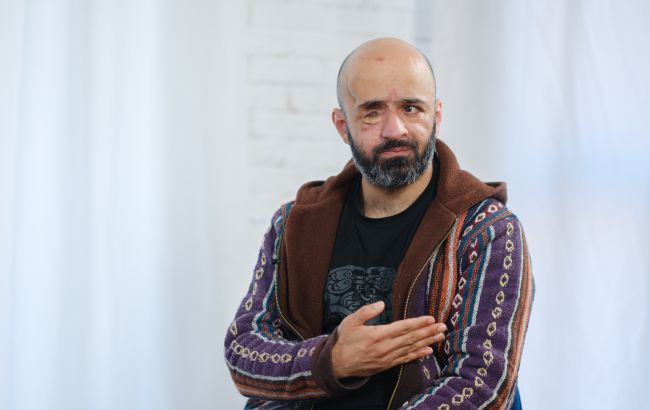 "Хоча б день походіть без ока": Масі Найєм розповів, чи поважають українці військових з інвалідністю